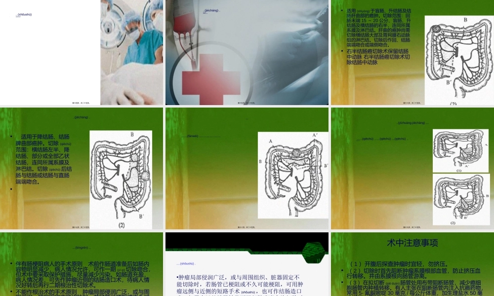2022年医学专题—结肠癌结肠癌摘要(1).ppt
