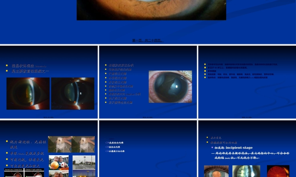 2022年医学专题—老年性白内障(1).ppt