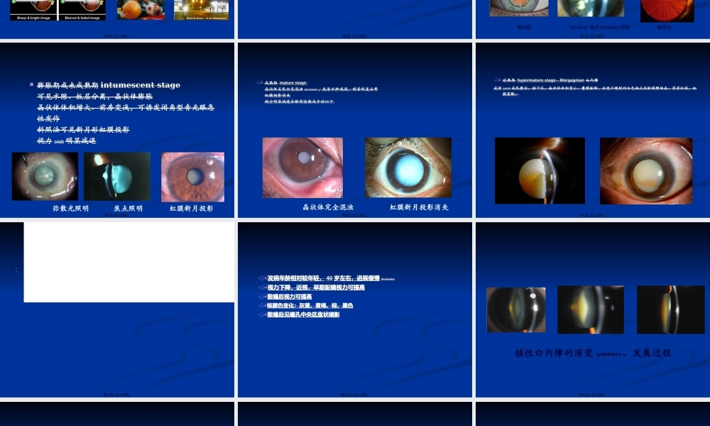 2022年医学专题—老年性白内障(1).ppt