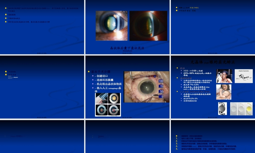 2022年医学专题—老年性白内障(1).ppt