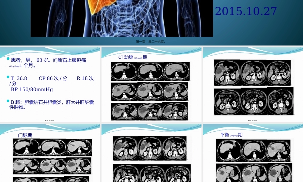 2022年医学专题—肝包虫病(1).pptx