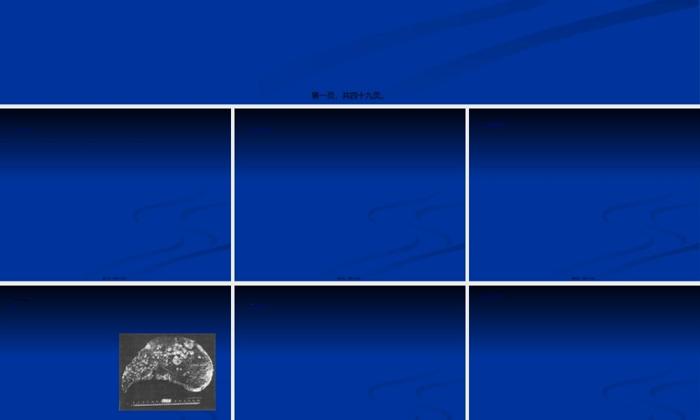 2022年医学专题—肝硬化病人常有腹水(1).ppt