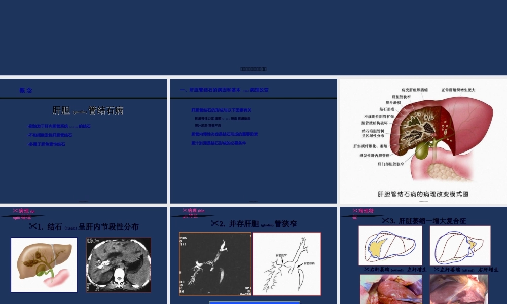 2022年医学专题—肝胆管结石诊治规范(1).ppt