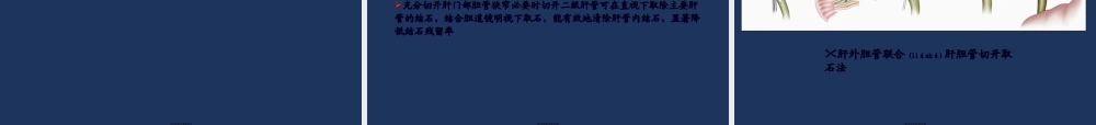 2022年医学专题—肝胆管结石诊治规范(1).ppt