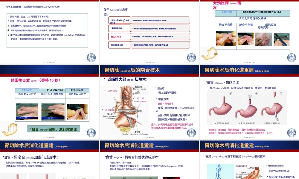 2022年医学专题—肠肠吻合技术--杨烈(9.16)(1).pptx