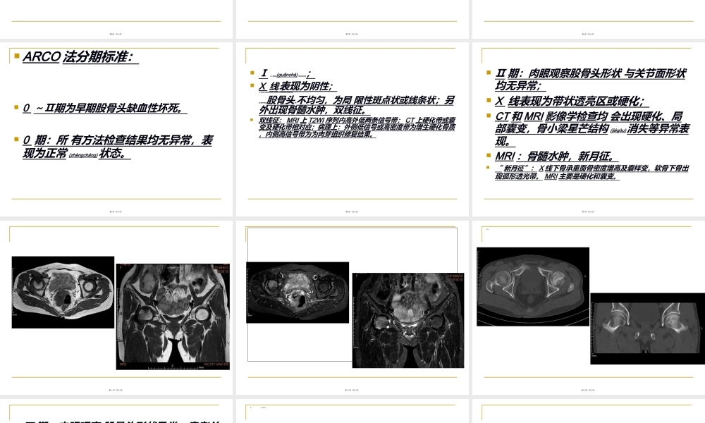 2022年医学专题—股骨头缺血性坏死(1).ppt