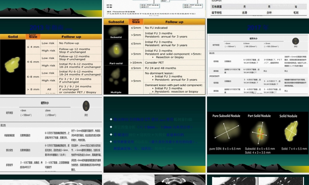 2022年医学专题—肺偶发结节处理指南(1).pptx