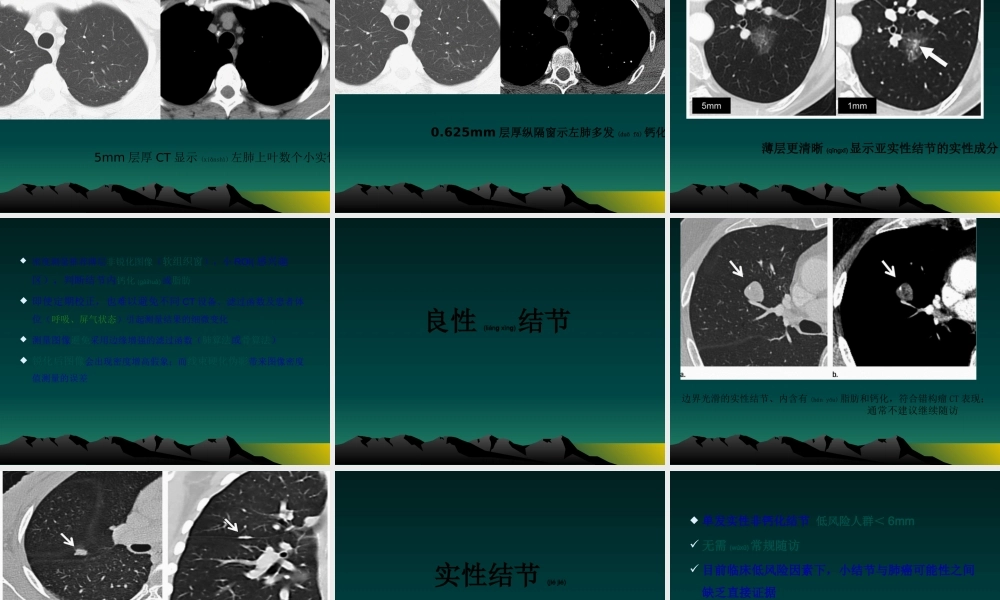 2022年医学专题—肺偶发结节处理指南(1).pptx