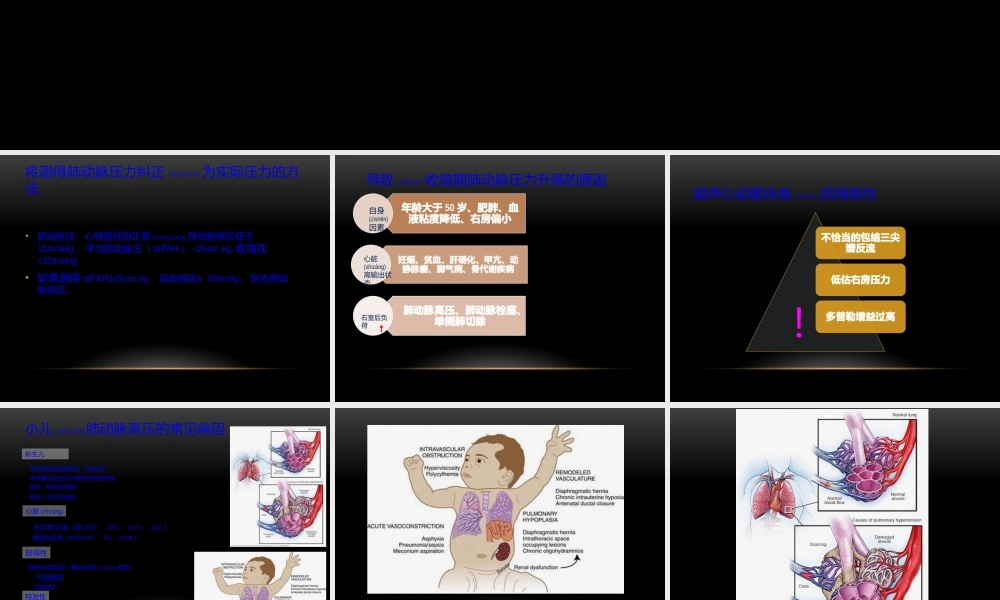 2022年医学专题—肺动脉高压的测量(1).pptx