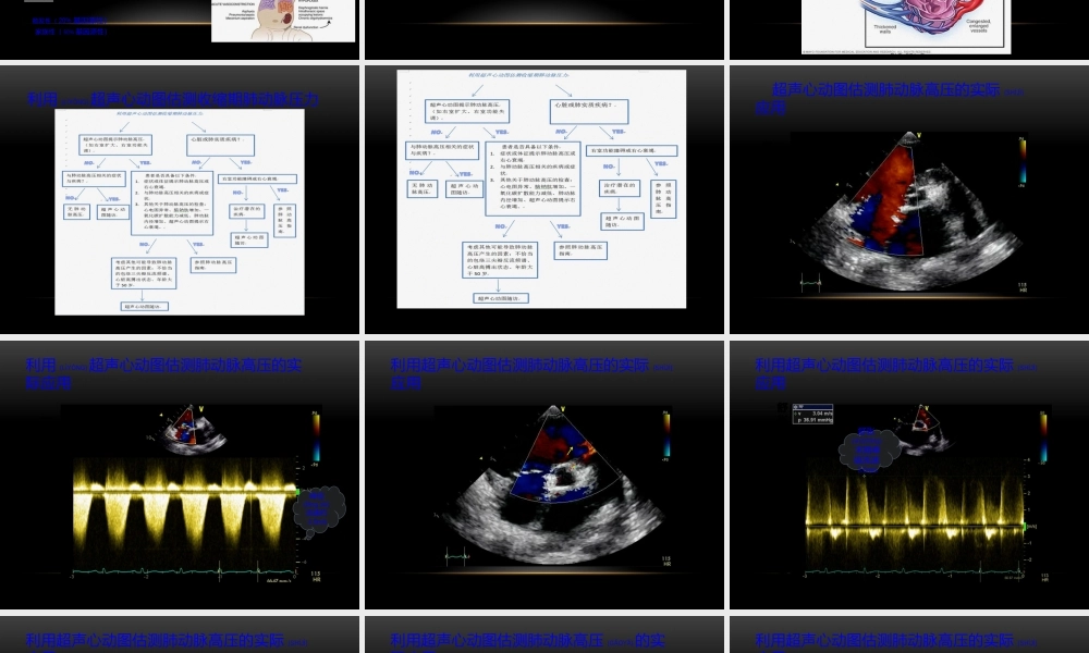 2022年医学专题—肺动脉高压的测量(1).pptx