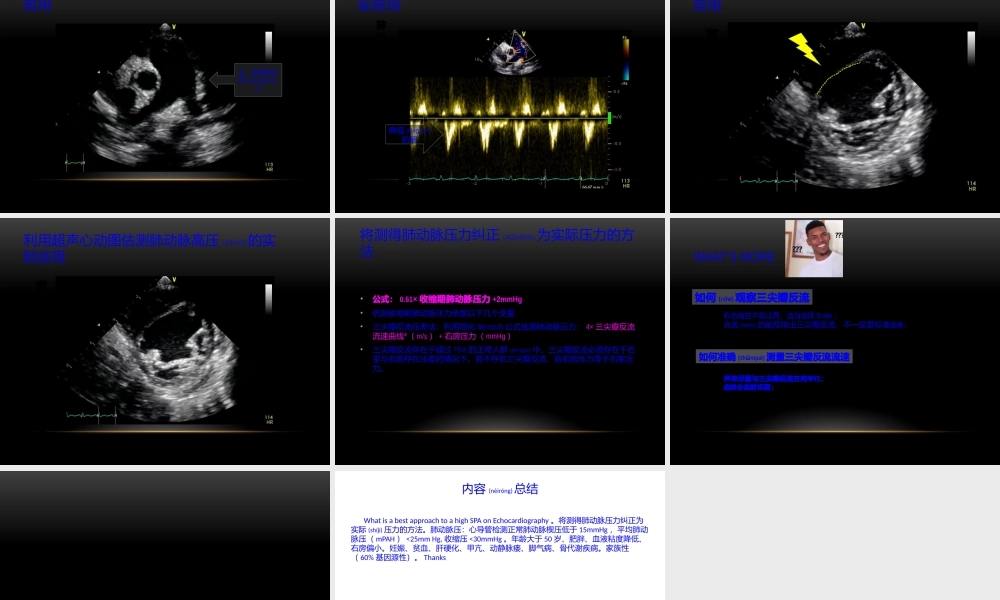 2022年医学专题—肺动脉高压的测量(1).pptx
