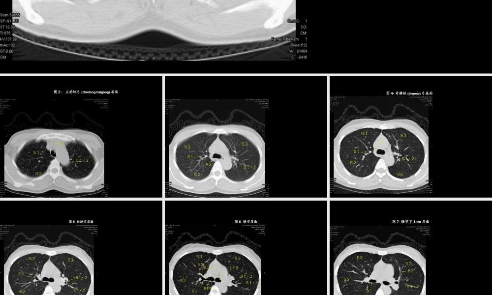 2022年医学专题—肺段ct(1).ppt
