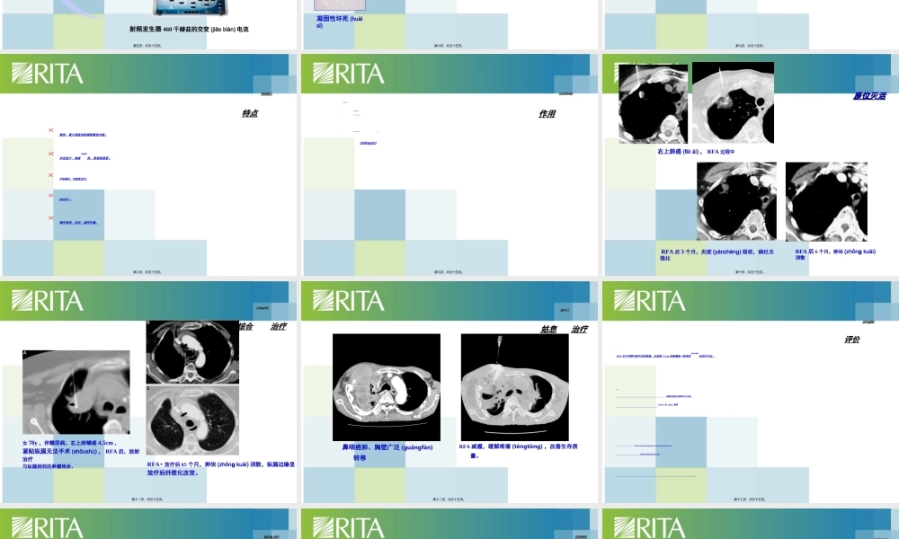 2022年医学专题—肺癌射频消融(1).ppt