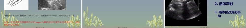 2022年医学专题—胆囊及胆管常见疾(1).ppt