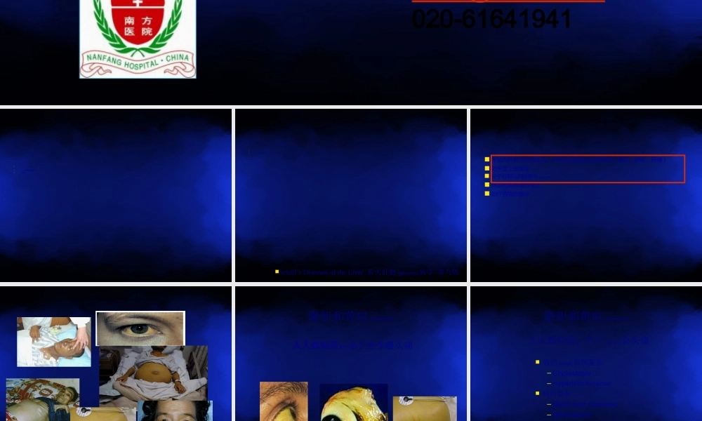 2022年医学专题—胆汁淤积和黄疸(1).ppt