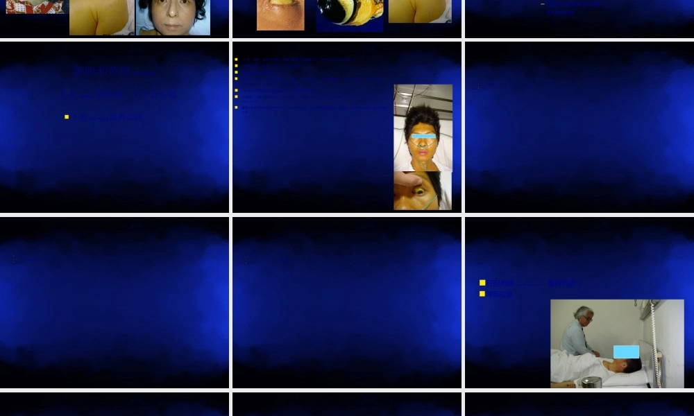 2022年医学专题—胆汁淤积和黄疸(1).ppt