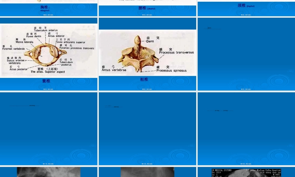 2022年医学专题—脊柱和骨盆骨折(1).ppt