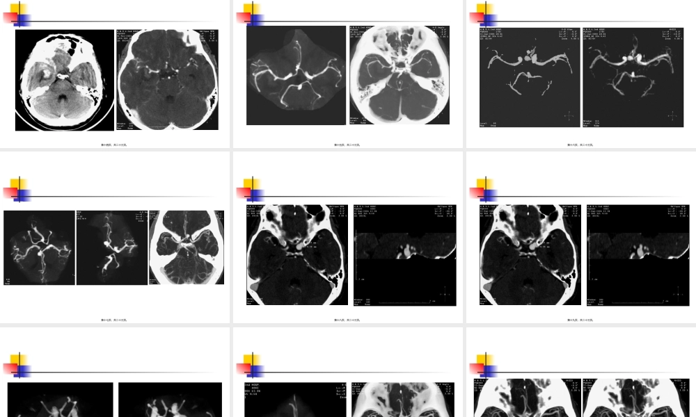 2022年医学专题—脑CTA后处理(1).ppt