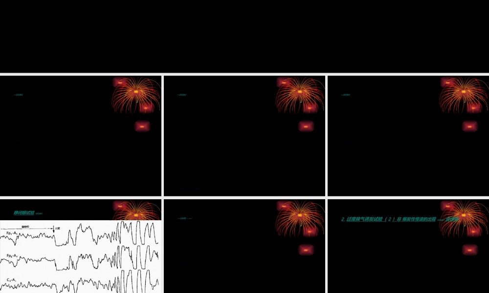 2022年医学专题—脑电图判读1(1).ppt