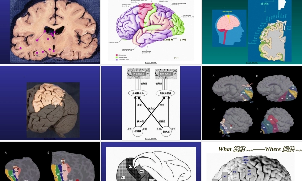 2022年医学专题—脑结构与认知(1).ppt