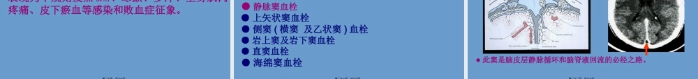 2022年医学专题—脑静脉系统血栓形成全面PPT概要(1).ppt