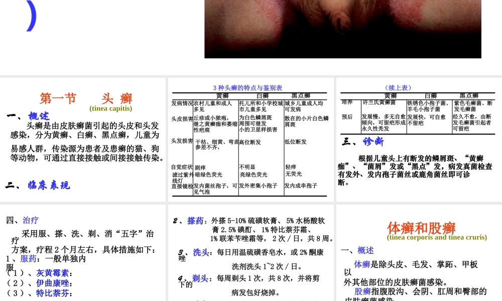 4真菌性皮肤病(1).ppt