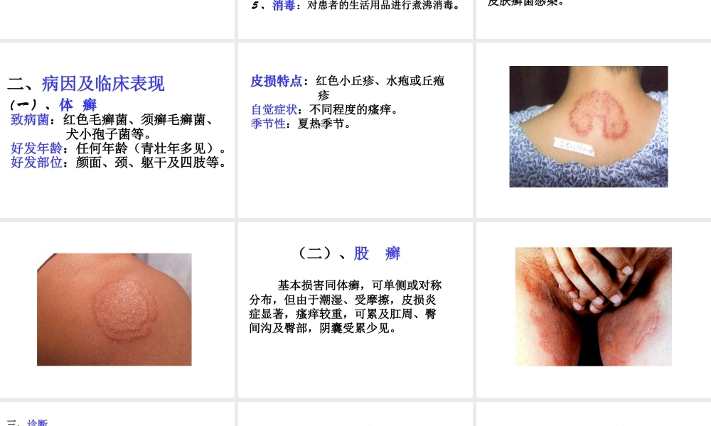 4真菌性皮肤病(1).ppt