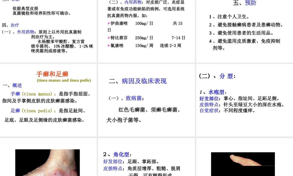 4真菌性皮肤病(1).ppt