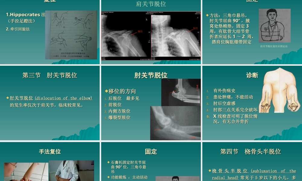 50-关节脱位-王俊勤(1).ppt