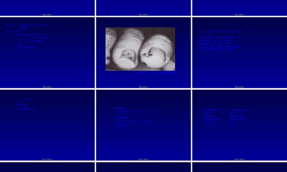 2022年医学专题—瓣膜病心内膜炎(1).ppt