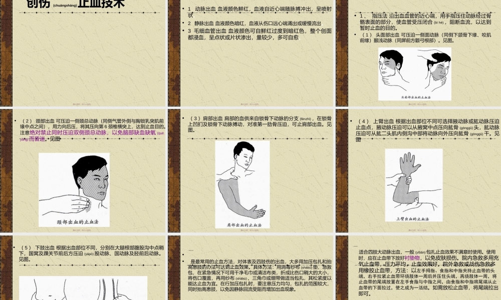 2022年医学专题—创伤救护a(1).ppt