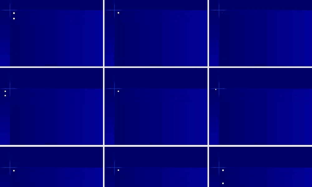 2022年医学专题—化脓性中耳乳突炎并发症汇编(1).ppt