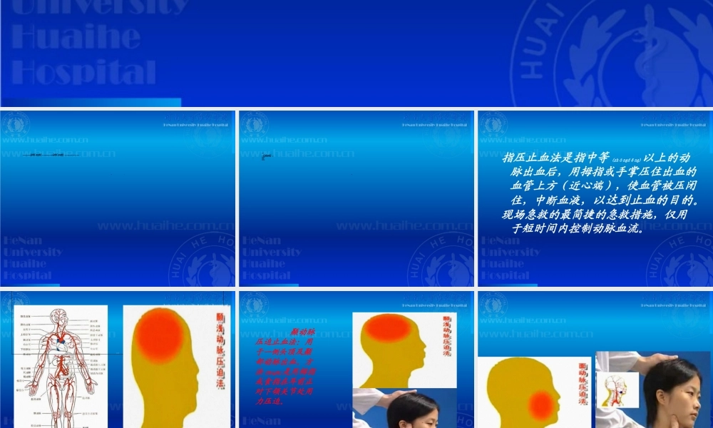 2022年医学专题—开放性伤口的止血包扎技术(1).ppt