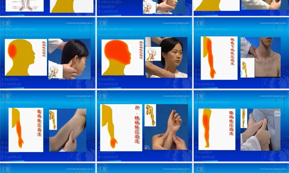 2022年医学专题—开放性伤口的止血包扎技术(1).ppt