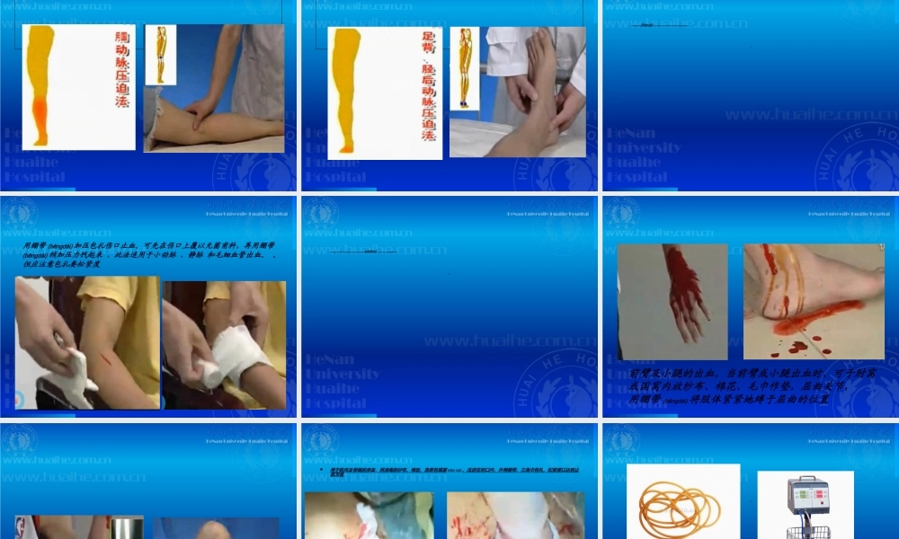 2022年医学专题—开放性伤口的止血包扎技术(1).ppt