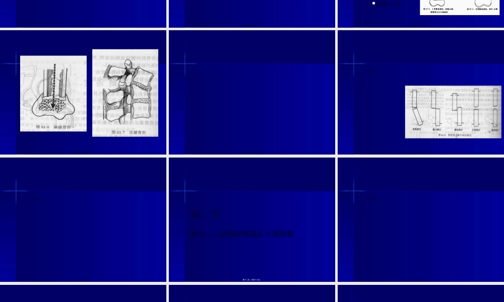 2022年医学专题—第62篇-骨折浅论(1).ppt