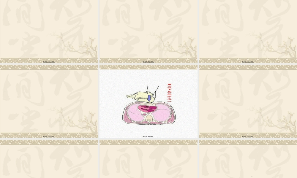 2022年医学专题—创伤急救及出血(1).ppt