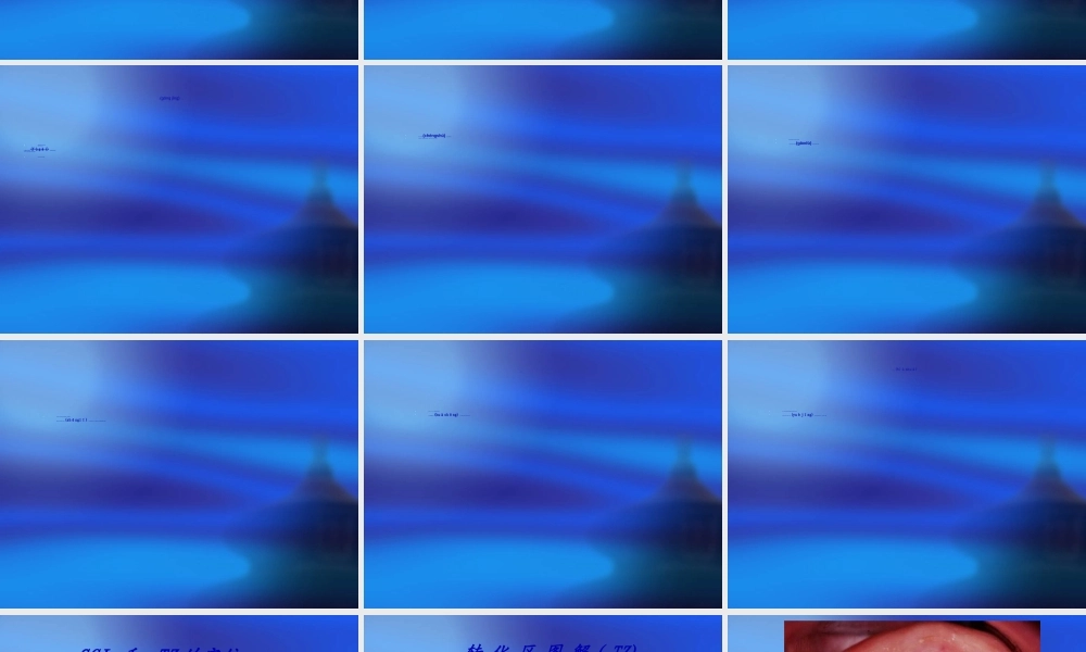 2022年医学专题—宫颈癌筛查技术推广(1).ppt