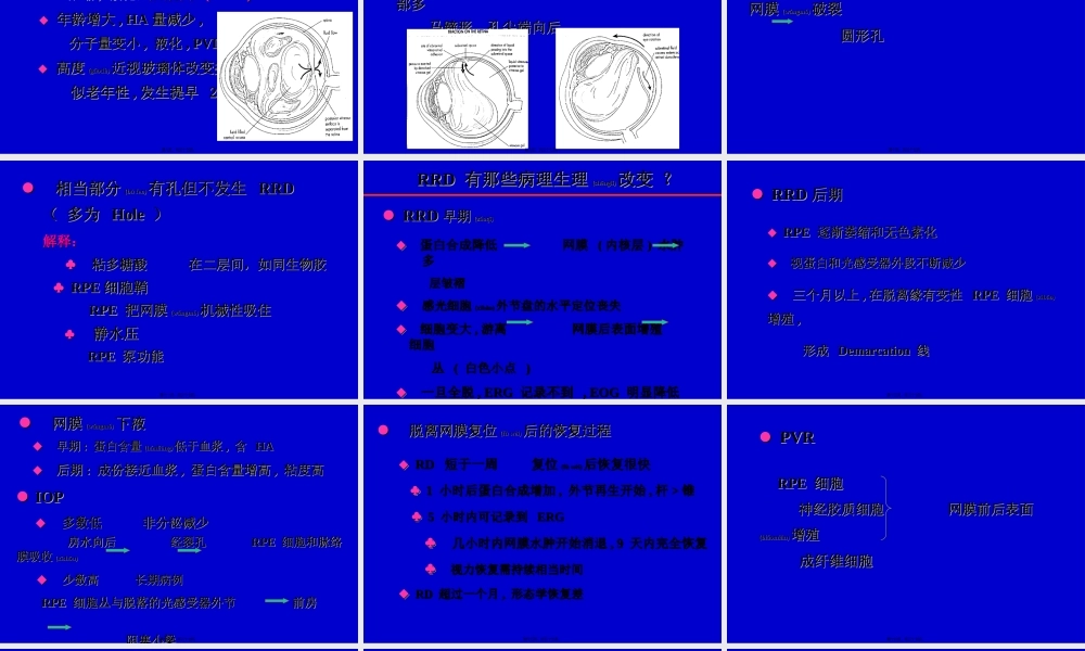 2022年医学专题—孔源性视网膜脱离诊治(1).ppt