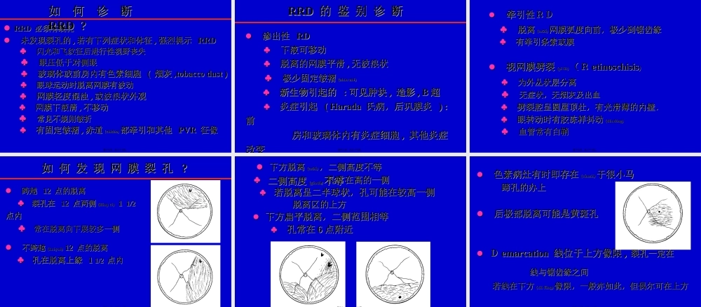 2022年医学专题—孔源性视网膜脱离诊治(1).ppt