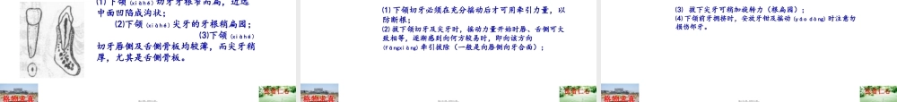 2022年医学专题—拔牙术2一般牙拔除术(1).ppt