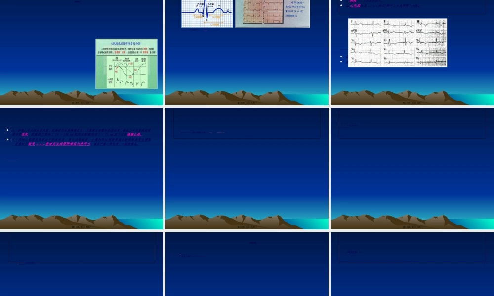 2022年医学专题—急性心肌梗死溶栓(1).ppt