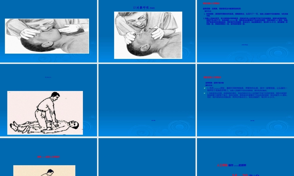 2022年医学专题—创伤急救12.6.15(1).ppt
