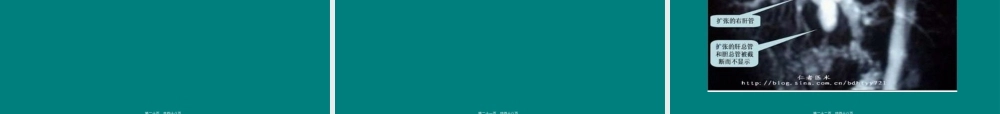 2022年医学专题—腹腔镜胆囊切除术相关并发症(1).ppt