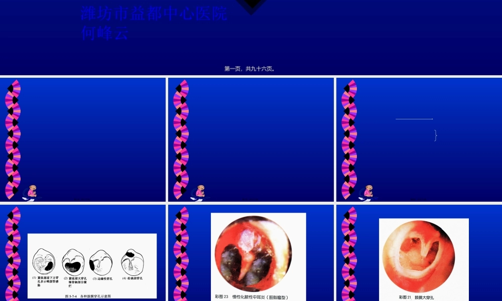 2022年医学专题—慢性中耳炎、耳聋、眩晕(1).ppt