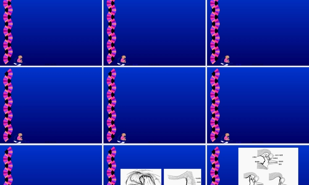 2022年医学专题—慢性中耳炎、耳聋、眩晕(1).ppt