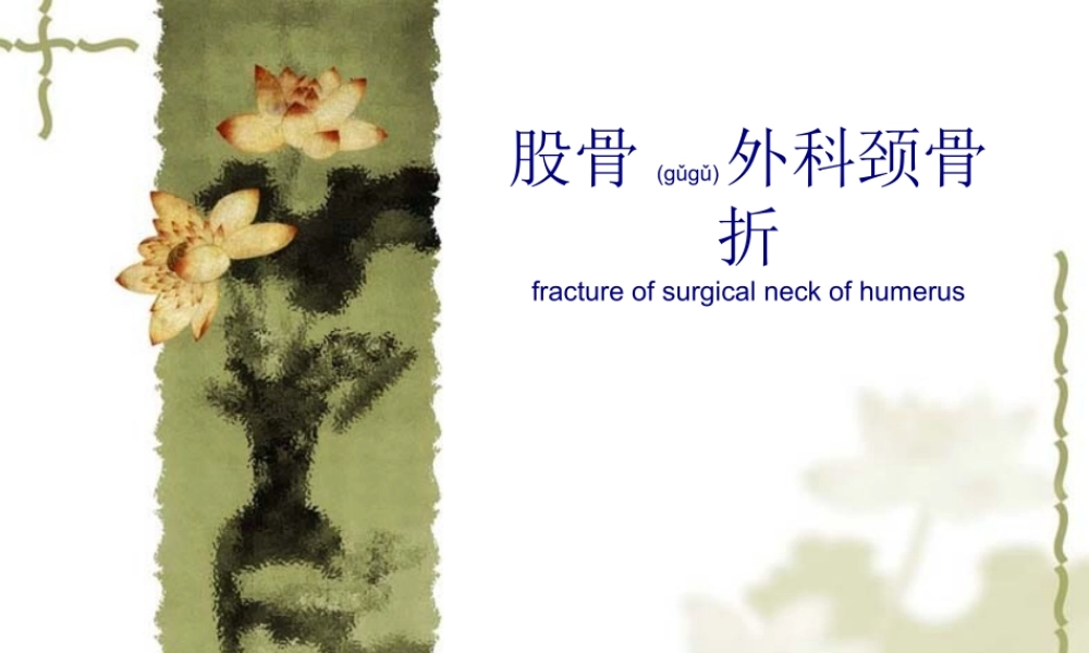 2022年医学专题—股骨外科颈骨折演示(1).ppt