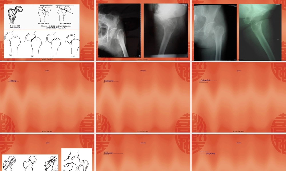2022年医学专题—利于骨痂形成促进骨折愈合(1).ppt