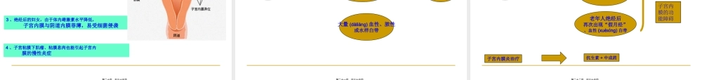 2022年医学专题—宫颈炎、附件炎、盆腔炎...(1).ppt