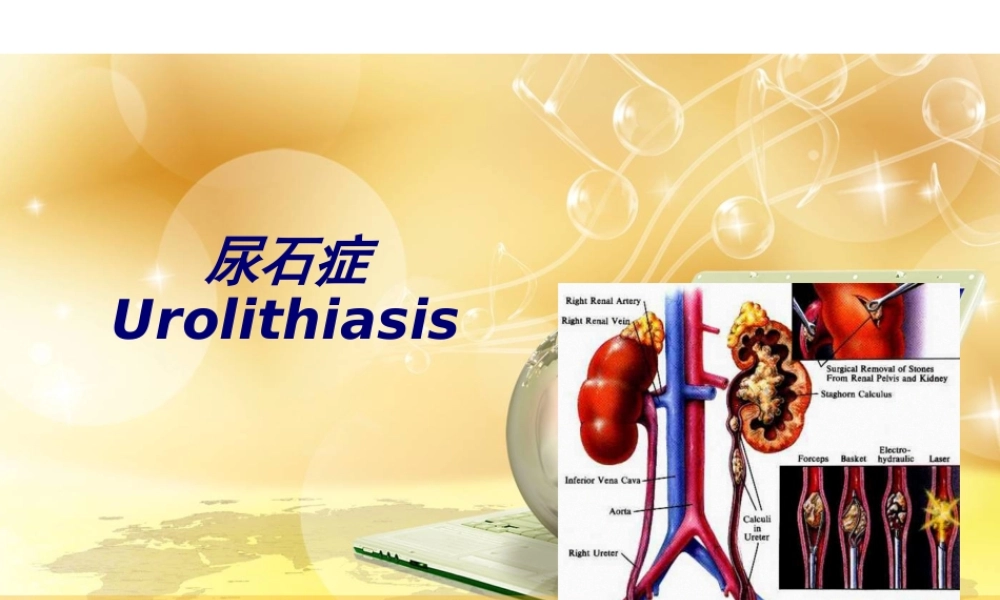 2022年医学专题—泌尿系结石(1).ppt